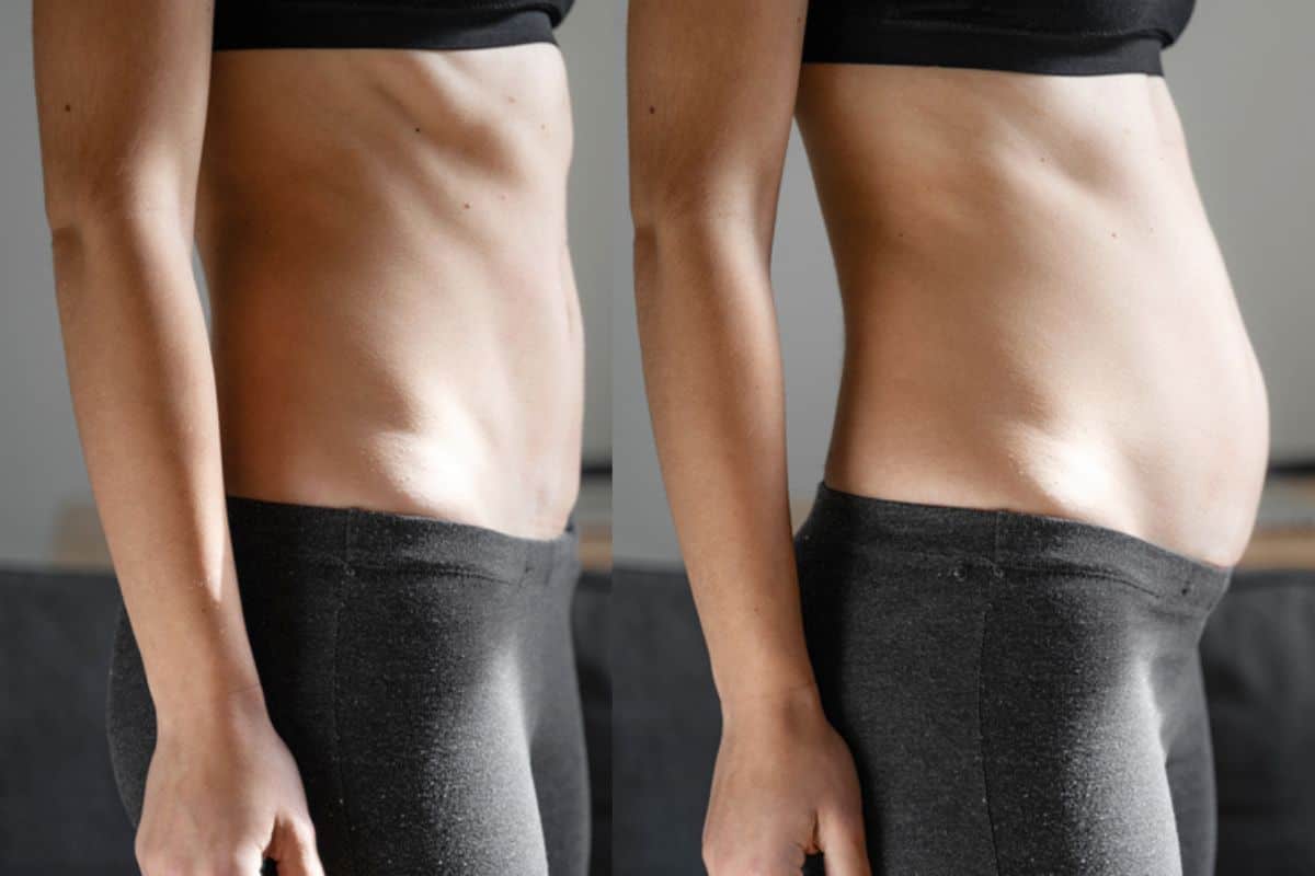 How long does diastasis recti take to improve West Yorkshire?