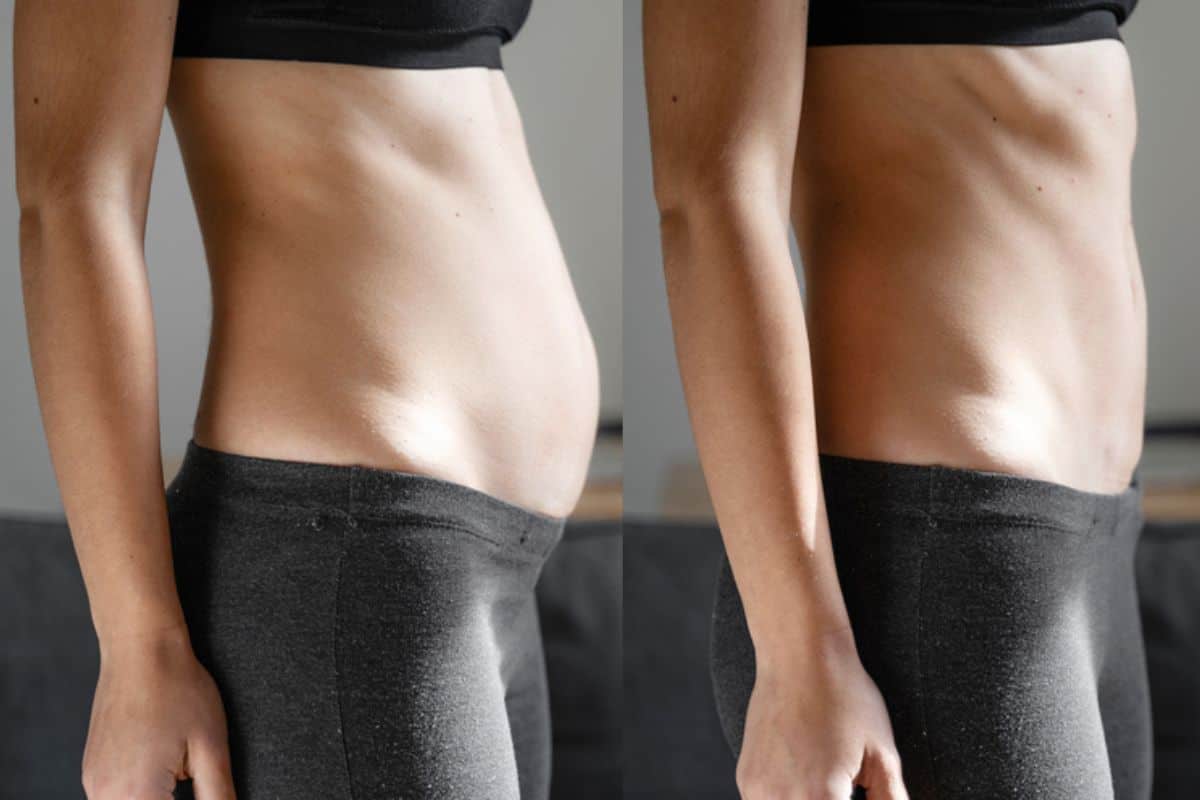 Post-Pregnancy: What Happens to Your Abdominal Muscles After Birth West Yorkshire