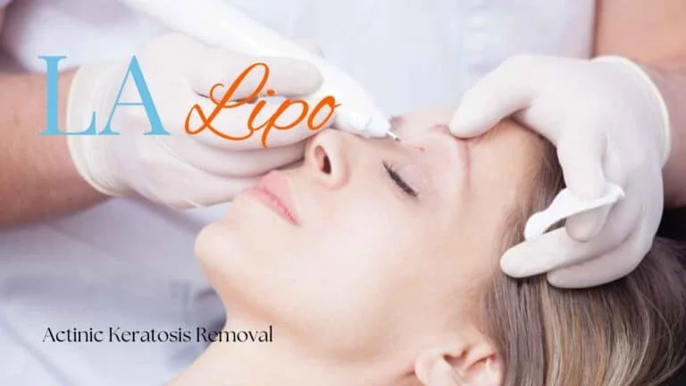Woman receiving Actinic Keratosis Removal Treatment West Yorkshire