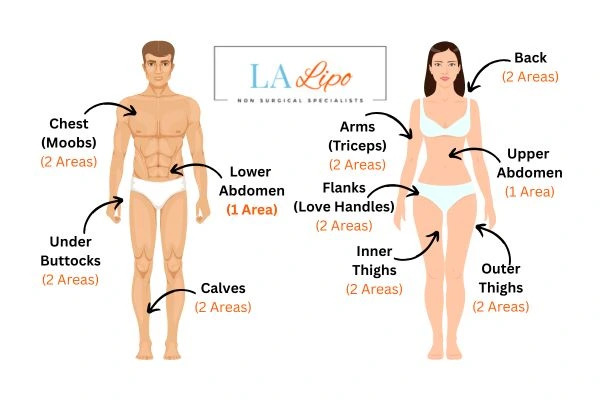 LA LIPO Cryolipolysis Areas West Yorkshire