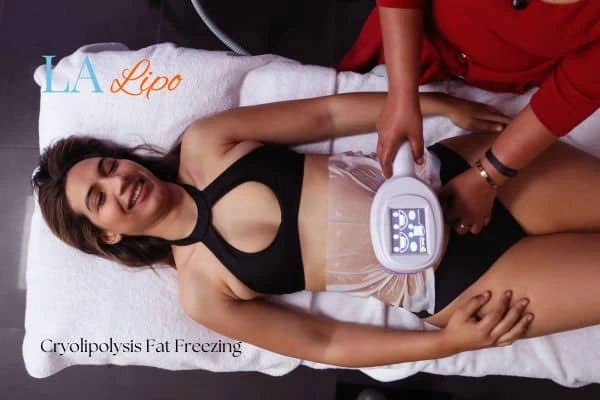 woman getting cryolipolysis West Yorkshire