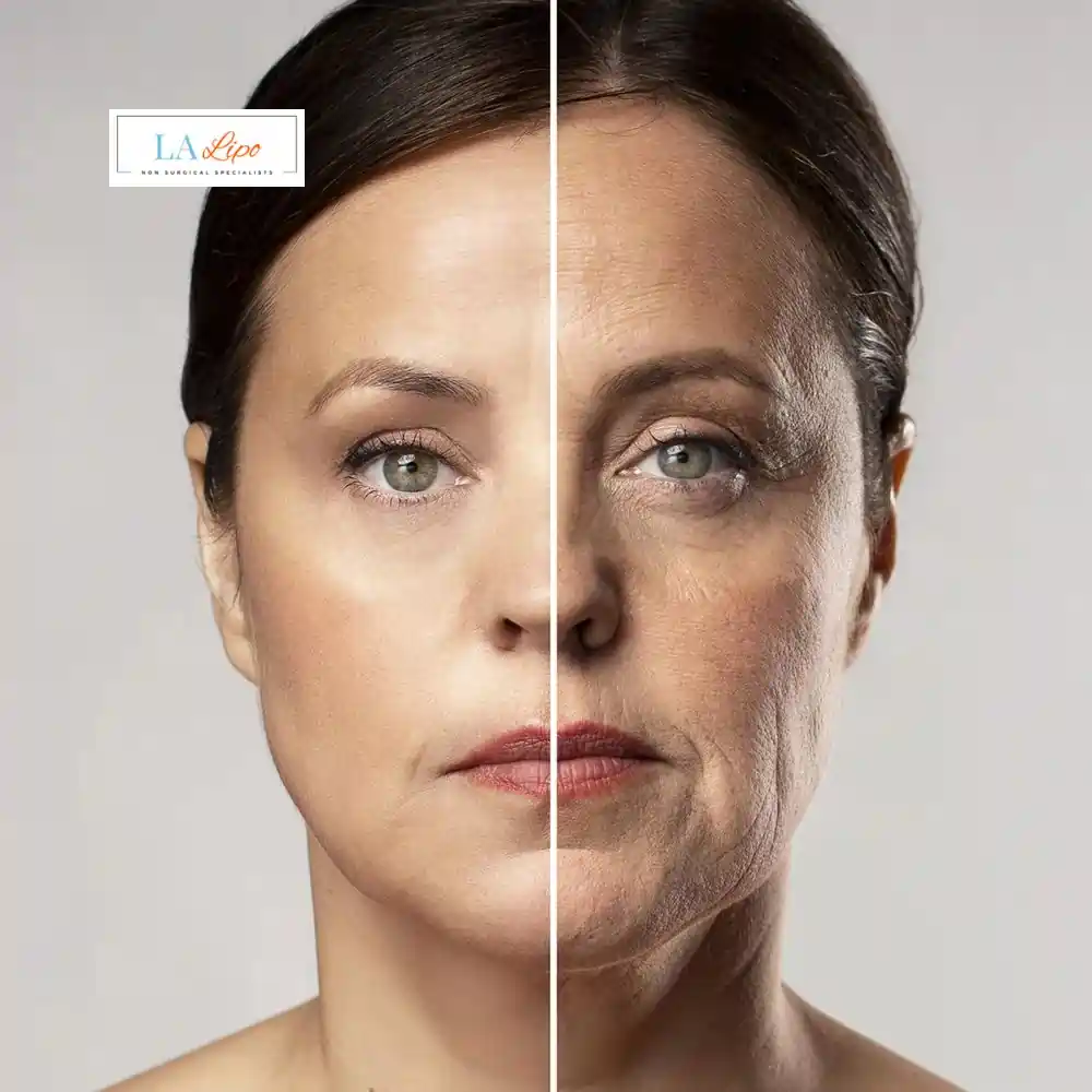 How Can You Tell If Non-Surgical Skin Tightening Is Right for You West Yorkshire?