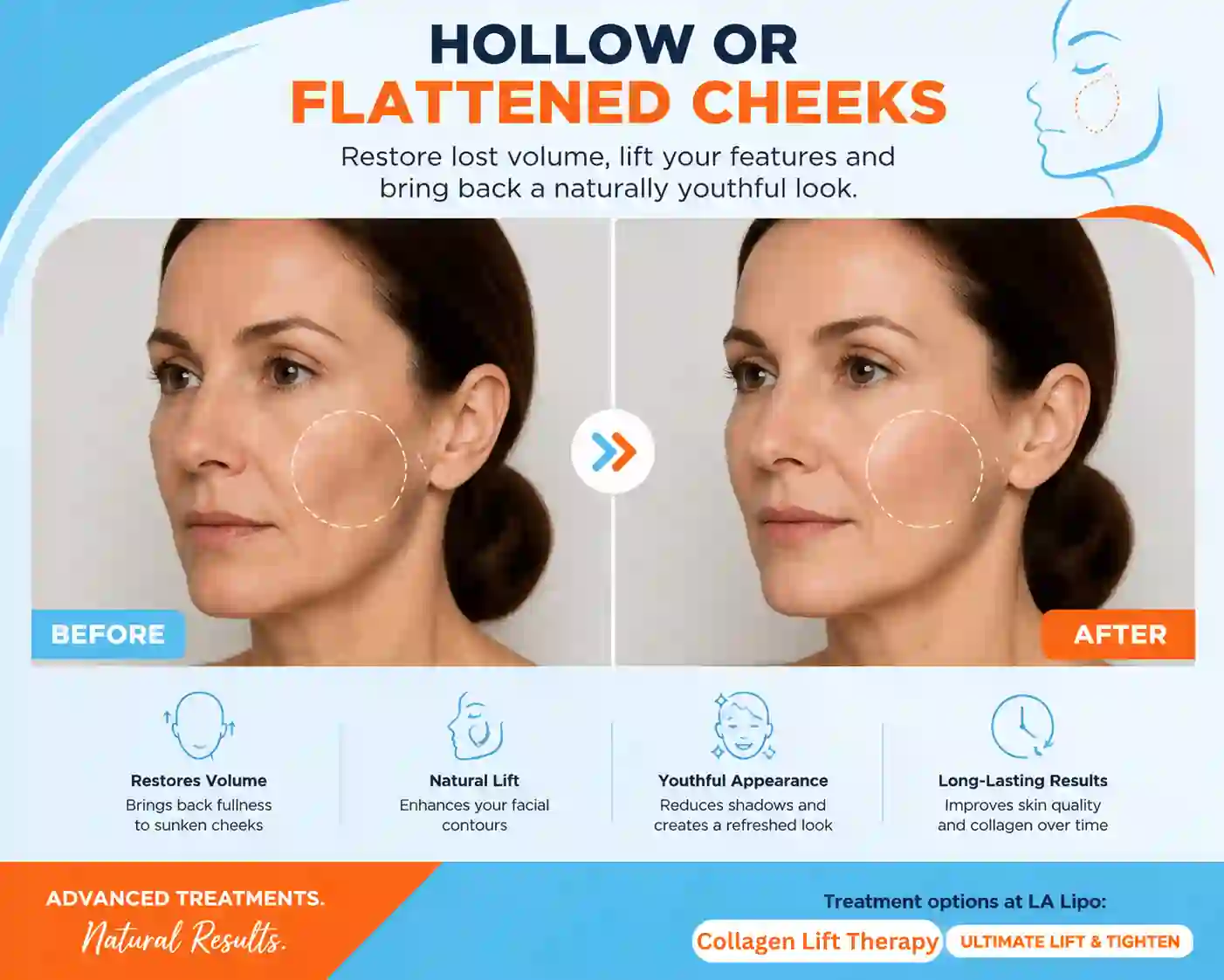 Sign #4: Hollow or Flattened Cheeks West Yorkshire