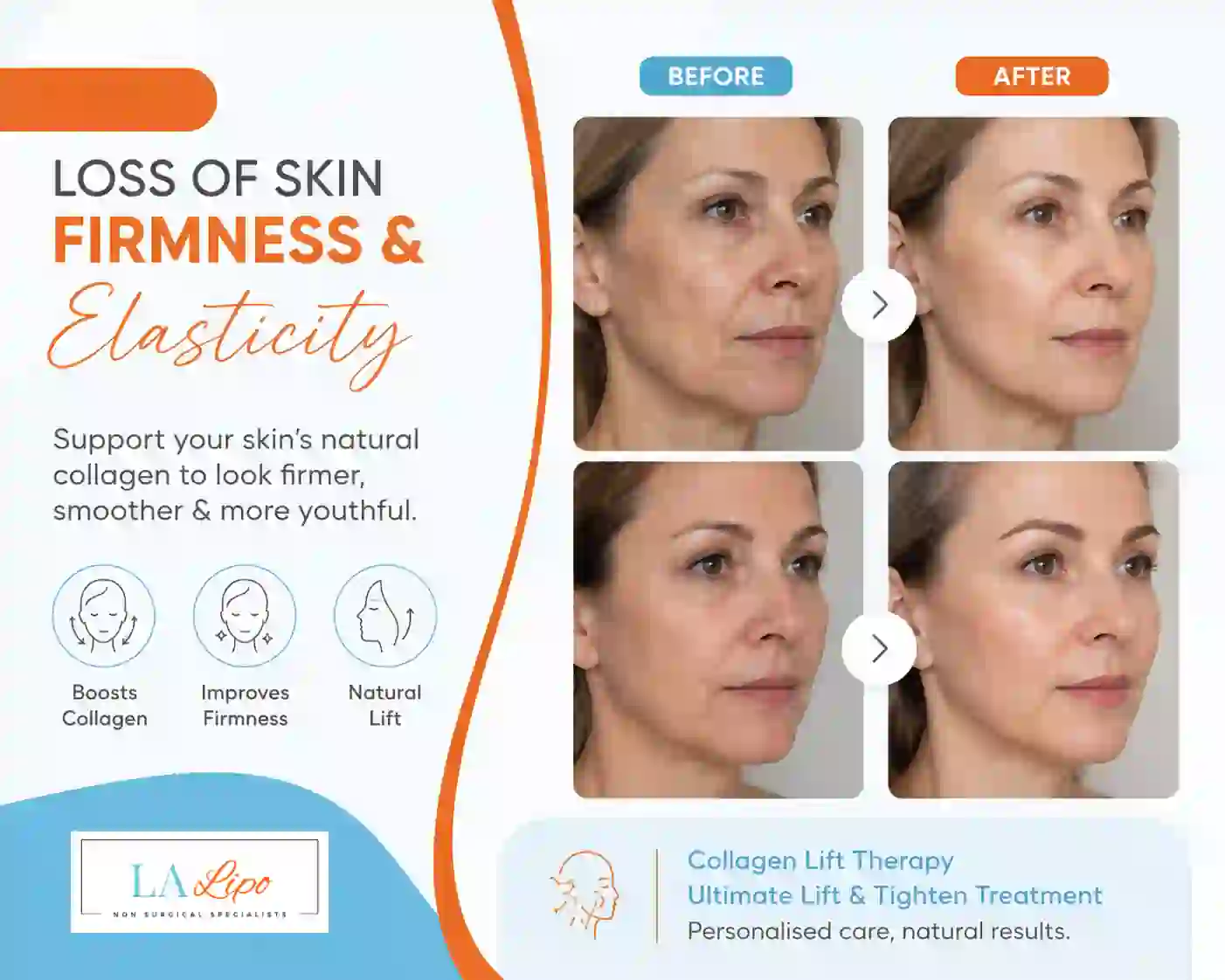 Sign #7: Loss of Skin Firmness and Elasticity West Yorkshire