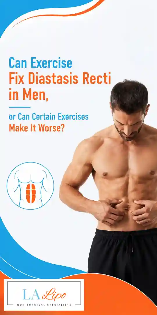 Can Exercise Fix Diastasis Recti in Men, or Can Certain Exercises Make It Worse West Yorkshire?