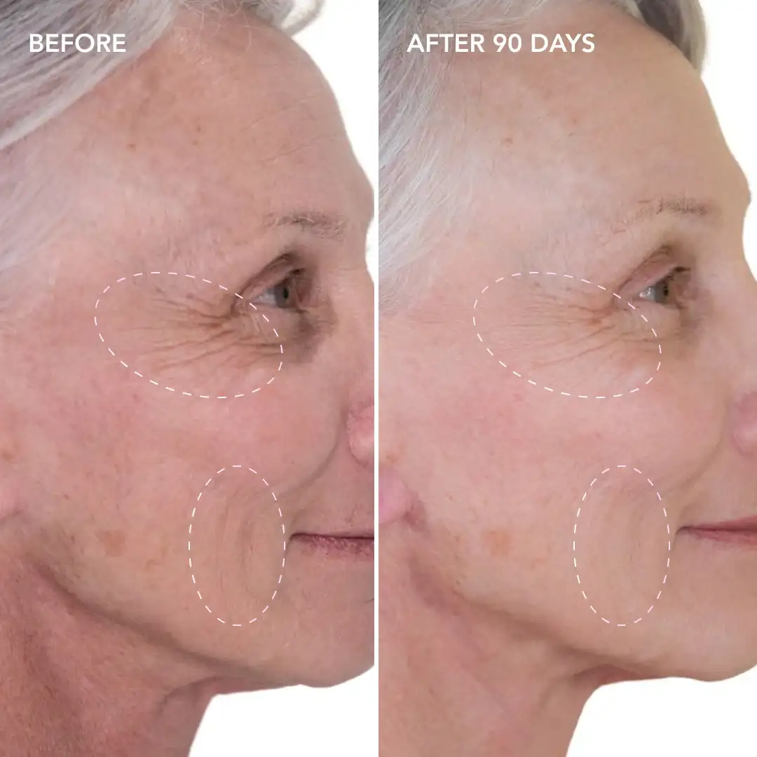 When will you see results West Yorkshire